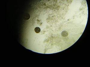 Microscopisch beeld van witte stip